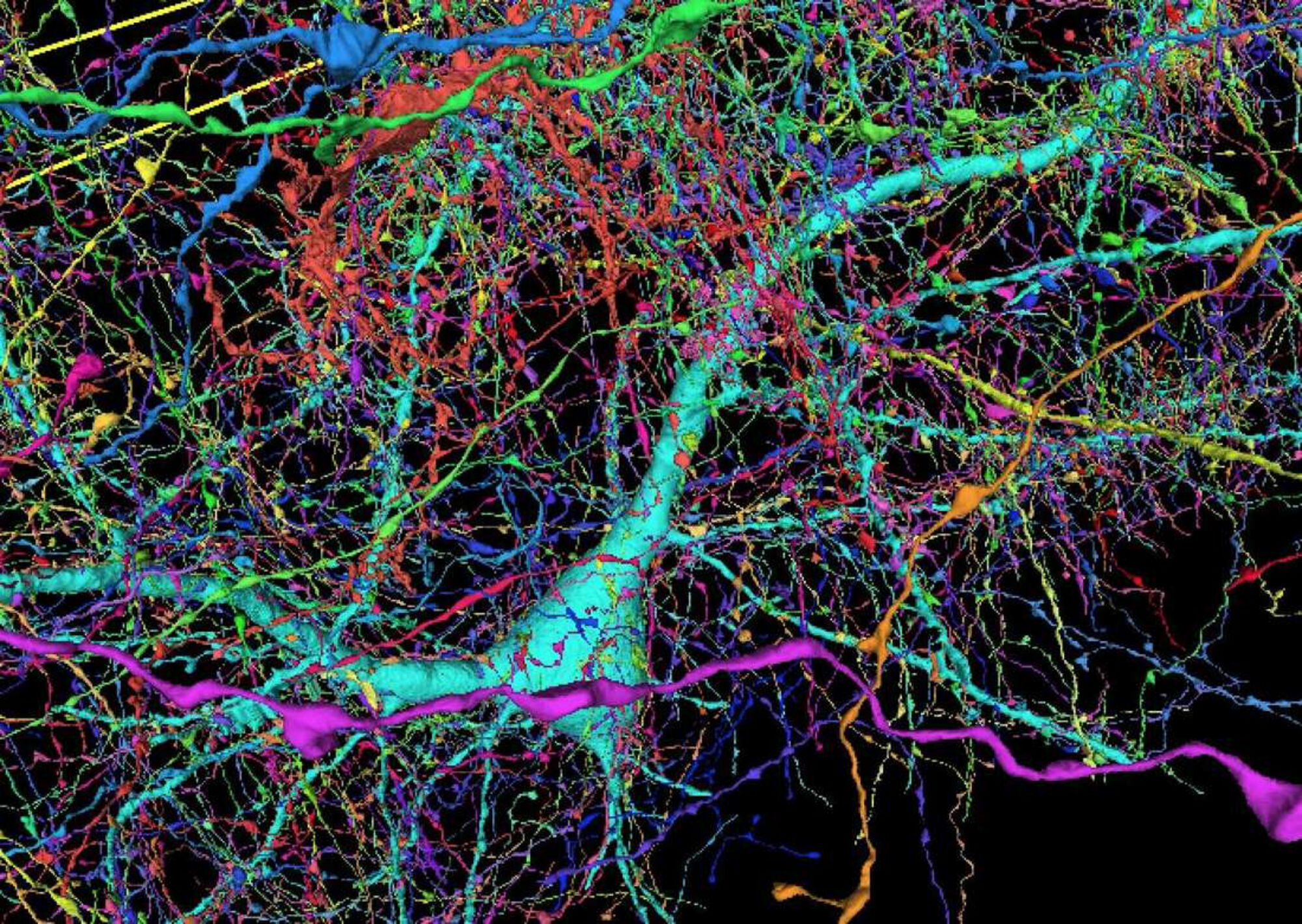 Клетки мозга. Нейронные связи. Нейронные клетки головного мозга. Нейронные связи в мозге. Клетки мозга виды